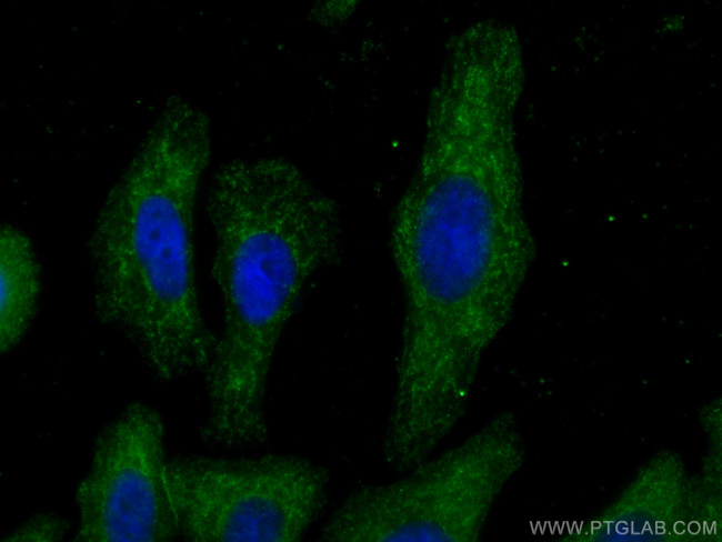 C1QA Antibody in Immunocytochemistry (ICC/IF)