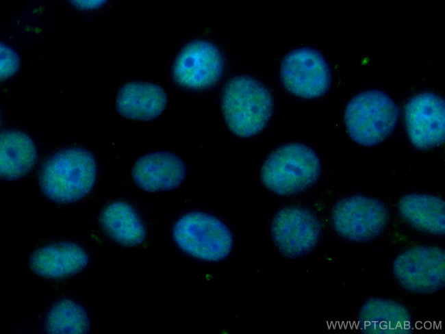 Cyclin H Antibody in Immunocytochemistry (ICC/IF)
