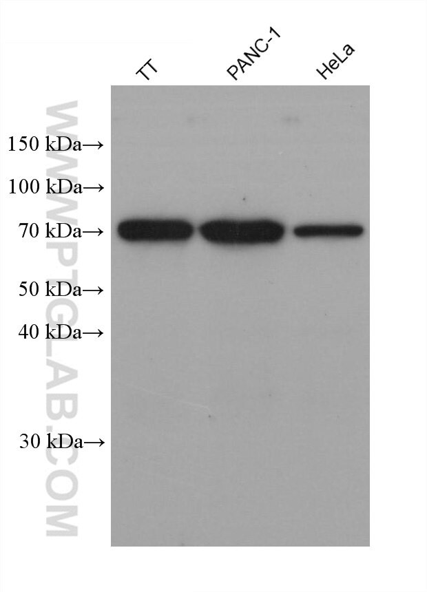 ESD Antibody in Western Blot (WB)