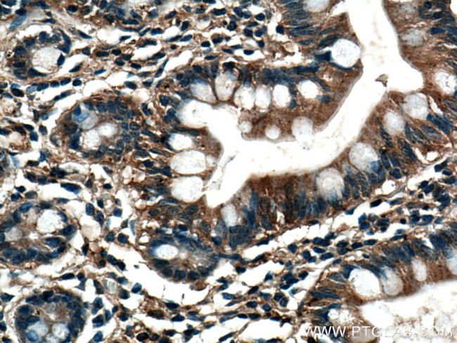 TRIM40 Antibody in Immunohistochemistry (Paraffin) (IHC (P))