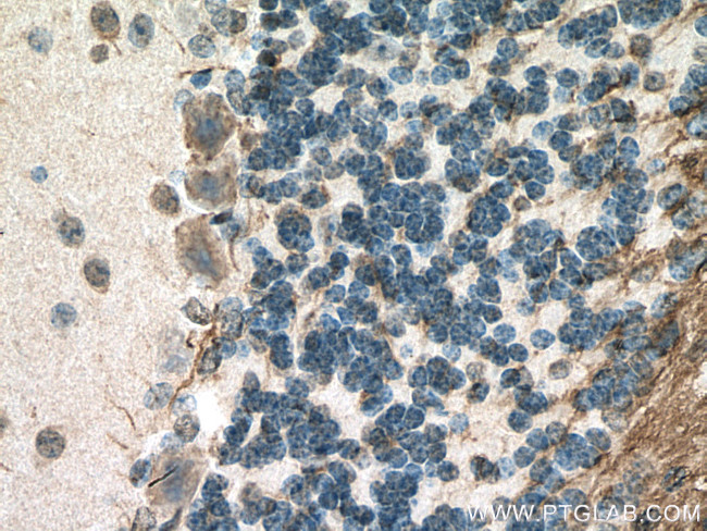 APBB1 Antibody in Immunohistochemistry (Paraffin) (IHC (P))