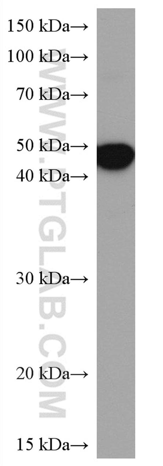 Alpha Sarcoglycan Antibody in Western Blot (WB)