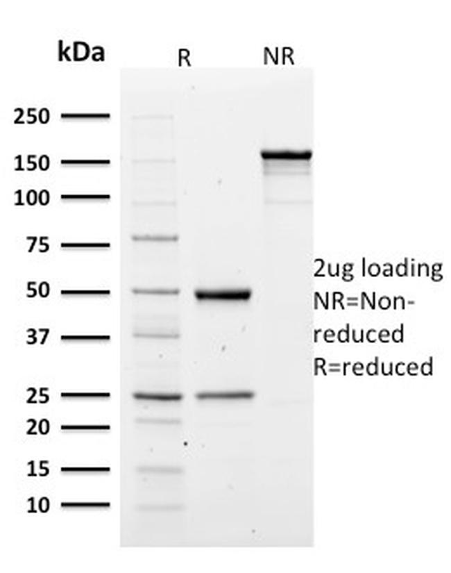 Spectrin Alpha 1 Monoclonal Antibody (SPTA1, 1810) (6708-MSM1-P1)