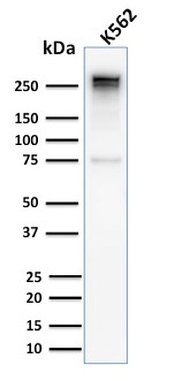 Spectrin Alpha 1 Recombinant Monoclonal Antibody (SPTA1, 2939R) (6708 ...