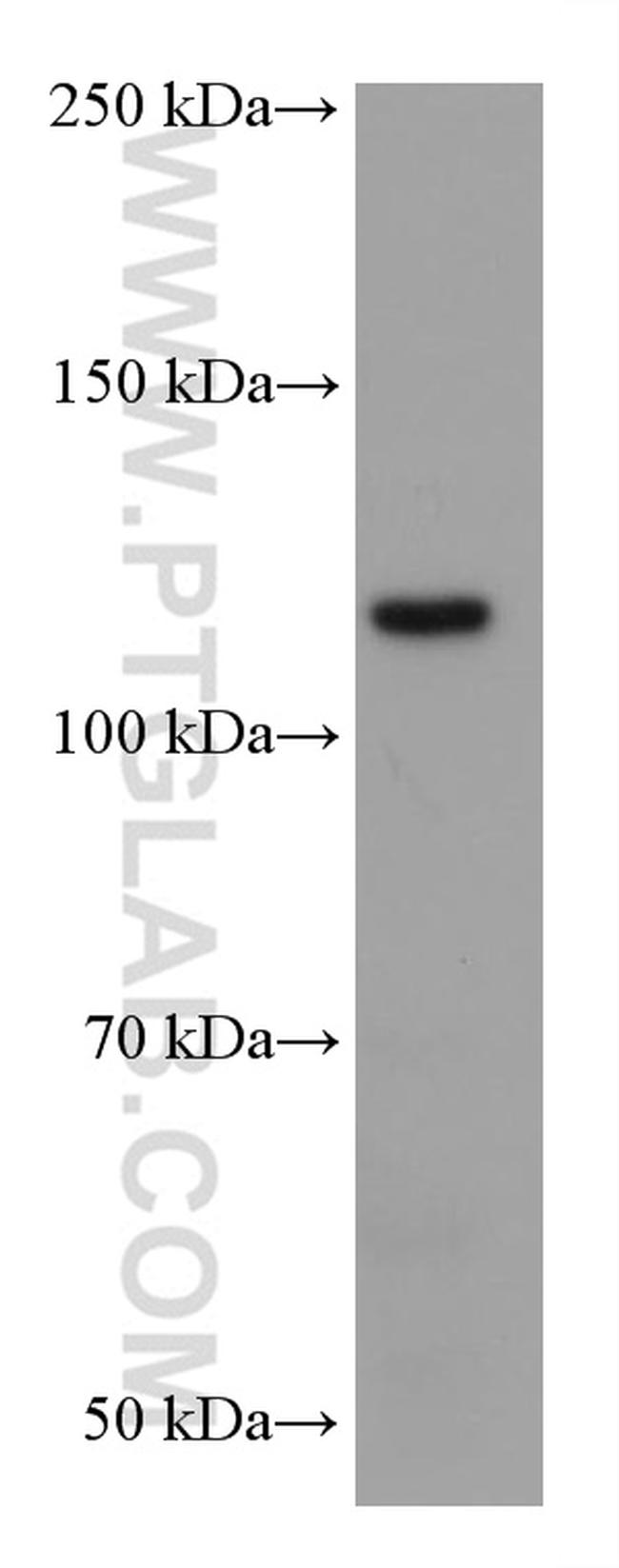 EPHB1 Antibody in Western Blot (WB)