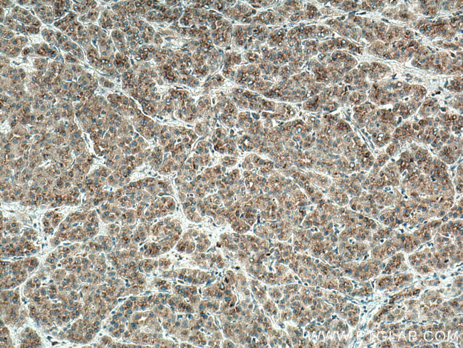 SDC2 Antibody in Immunohistochemistry (Paraffin) (IHC (P))