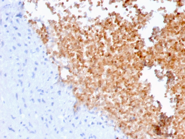 Fodrin/Alpha Spectrin II (SPTAN1)/NEAS Antibody in Immunohistochemistry (Paraffin) (IHC (P))
