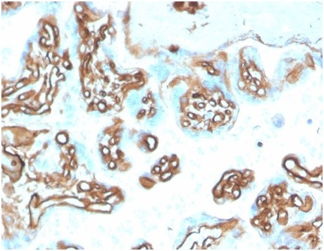 Fodrin/Alpha Spectrin II (SPTAN1)/NEAS Antibody in Immunohistochemistry (Paraffin) (IHC (P))