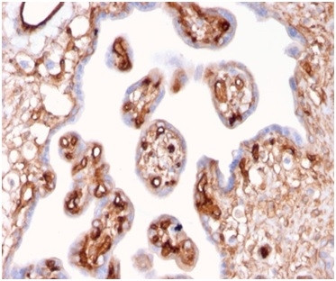 Fodrin/Alpha Spectrin II (SPTAN1)/NEAS Antibody in Immunohistochemistry (Paraffin) (IHC (P))