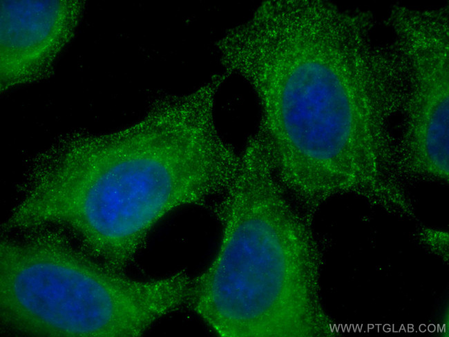ASAH1 Antibody in Immunocytochemistry (ICC/IF)