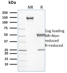 Spectrin beta I (SPTB) Antibody in SDS-PAGE (SDS-PAGE)