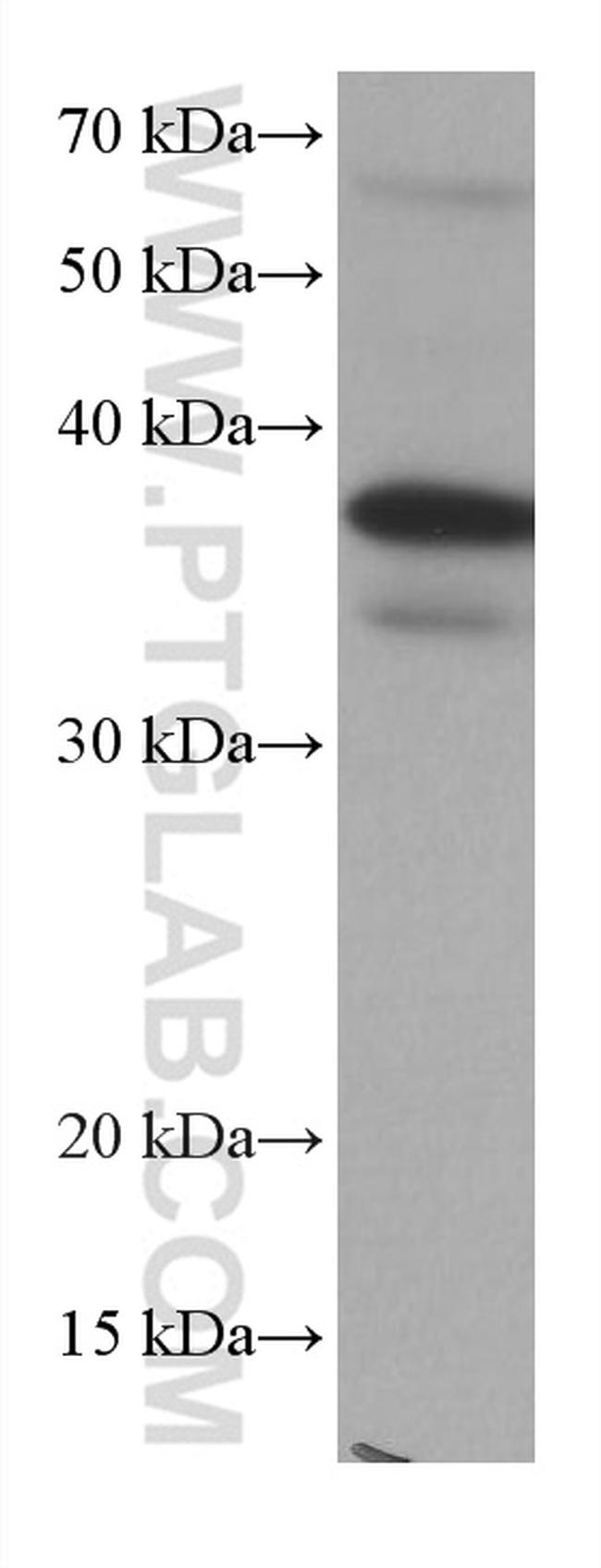 DUSP12 Antibody in Western Blot (WB)