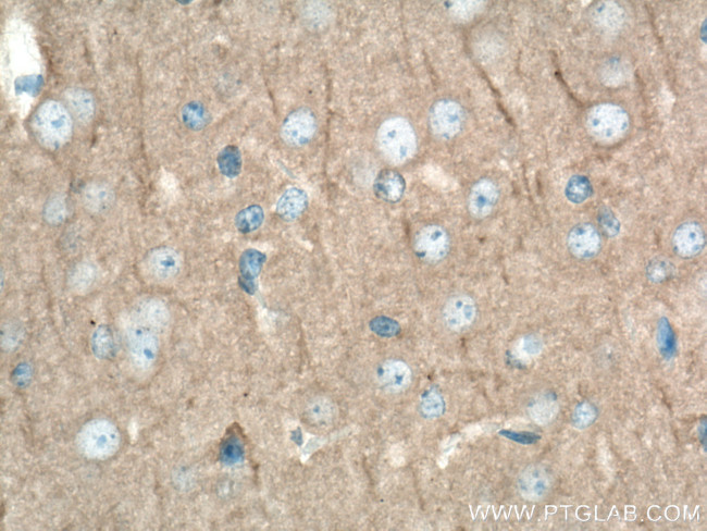 DLG3 Antibody in Immunohistochemistry (Paraffin) (IHC (P))