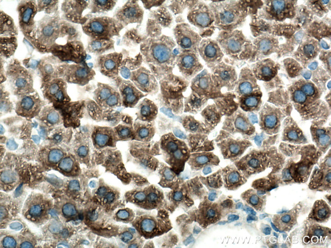 CYP3A4 Antibody in Immunohistochemistry (Paraffin) (IHC (P))