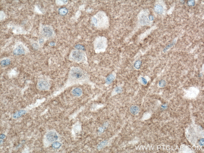 L1CAM Antibody in Immunohistochemistry (Paraffin) (IHC (P))