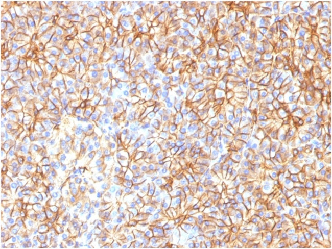 Spectrin beta III (SPTBN2) Monoclonal Antibody (SPTBN2, 1584) (6712 ...