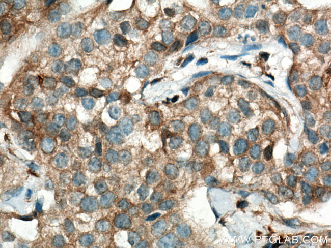 TRIM21 Antibody in Immunohistochemistry (Paraffin) (IHC (P))