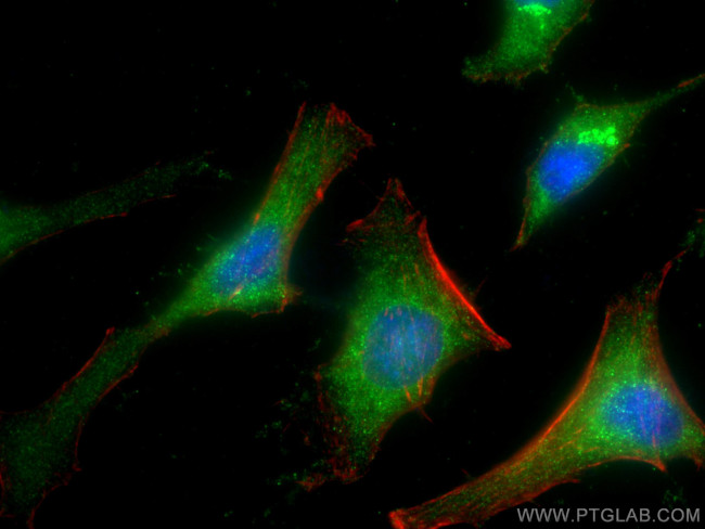 URG4 Antibody in Immunocytochemistry (ICC/IF)