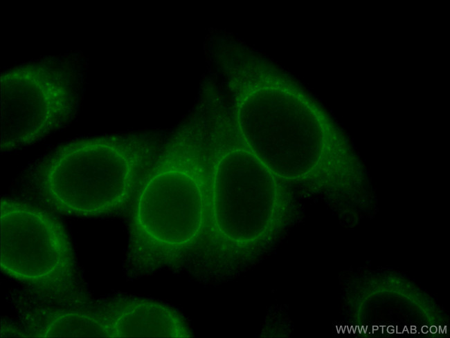 RANGAP1 Antibody in Immunocytochemistry (ICC/IF)