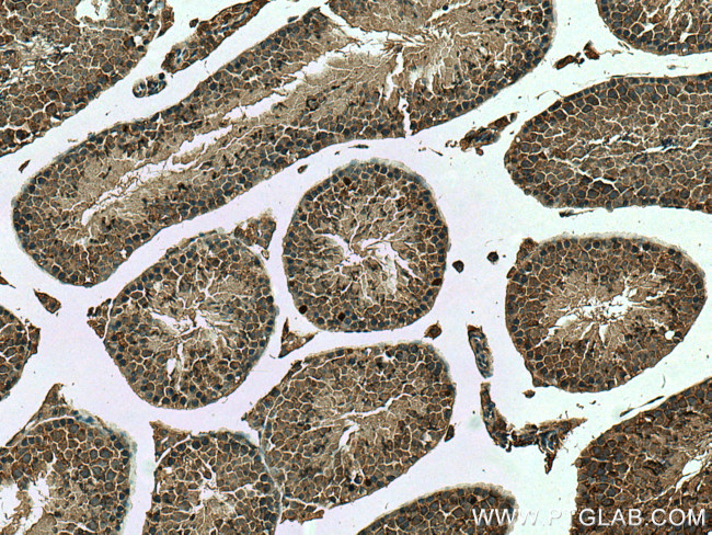 DDX4/VASA Antibody in Immunohistochemistry (Paraffin) (IHC (P))