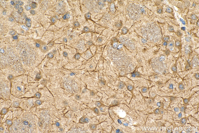 TROVE2 Antibody in Immunohistochemistry (Paraffin) (IHC (P))