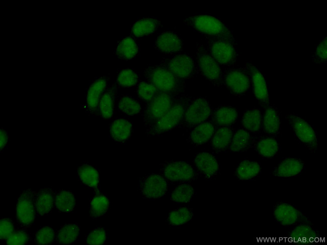SUMO2/3 Antibody in Immunocytochemistry (ICC/IF)