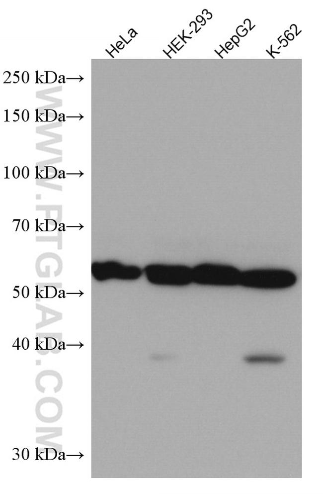 TMPO/LAP2 Antibody in Western Blot (WB)