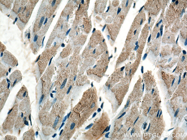 COQ6 Antibody in Immunohistochemistry (Paraffin) (IHC (P))