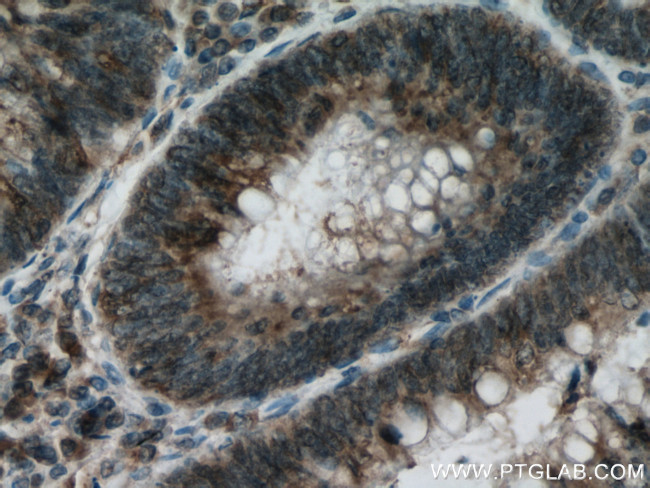 HIP1 Antibody in Immunohistochemistry (Paraffin) (IHC (P))