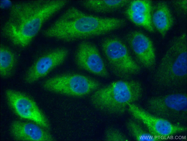 ACLY Antibody in Immunocytochemistry (ICC/IF)