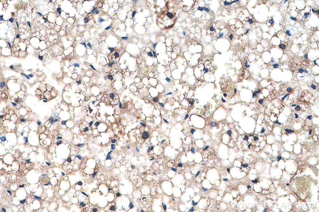FABP4 Antibody in Immunohistochemistry (Paraffin) (IHC (P))