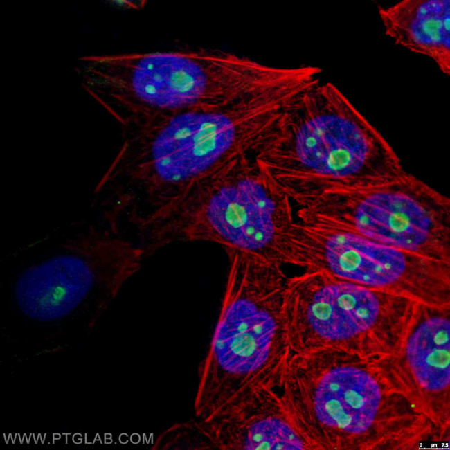 GNL3 Antibody in Immunocytochemistry (ICC/IF)