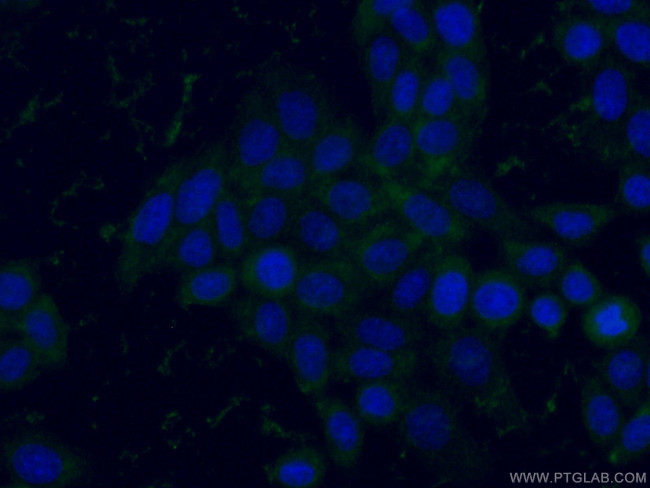 GPI Antibody in Immunocytochemistry (ICC/IF)