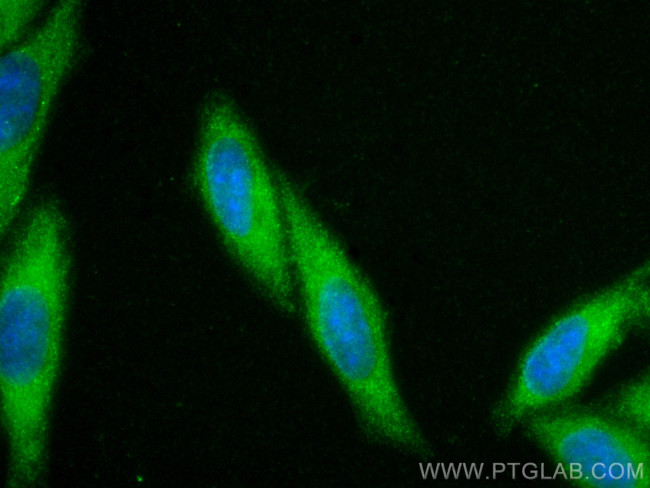 DNAJA1 Antibody in Immunocytochemistry (ICC/IF)