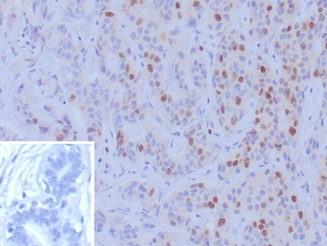 BRCA1 (Breast Marker) Antibody in Immunohistochemistry (Paraffin) (IHC (P))