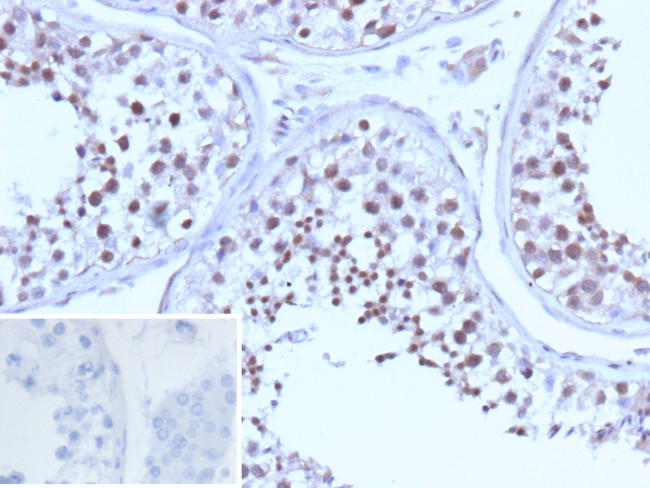 BRCA1 (Breast Marker) Antibody in Immunohistochemistry (Paraffin) (IHC (P))