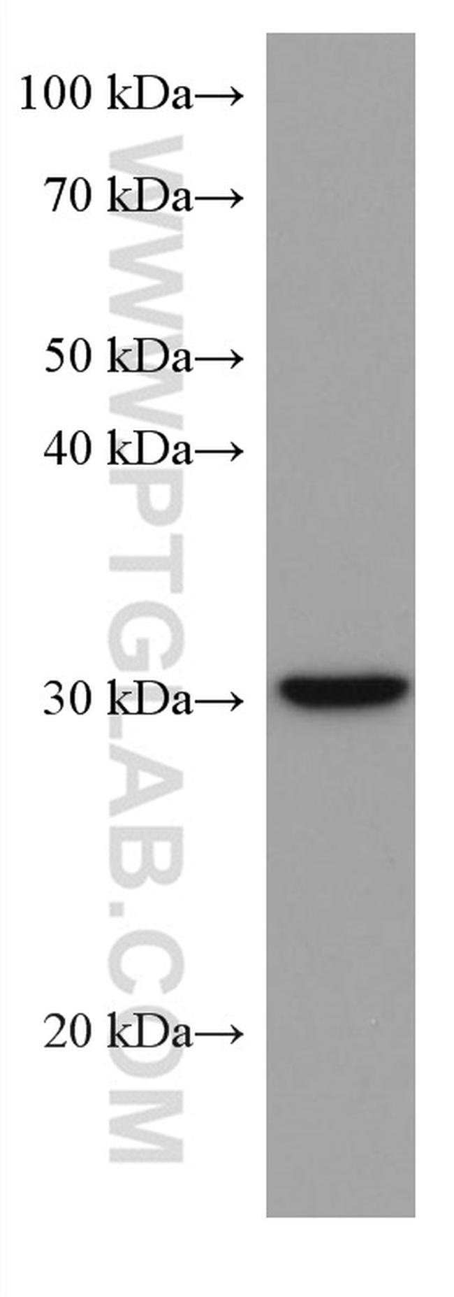 PITX2 Antibody in Western Blot (WB)