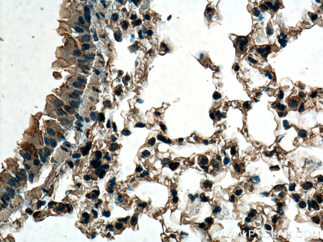 TMEM111 Antibody in Immunohistochemistry (Paraffin) (IHC (P))