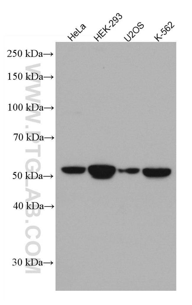 FGFR1OP Antibody in Western Blot (WB)