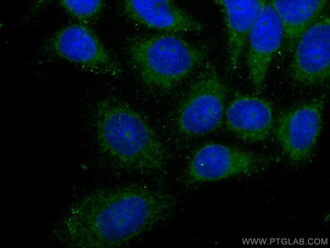 IFIT3 Antibody in Immunocytochemistry (ICC/IF)