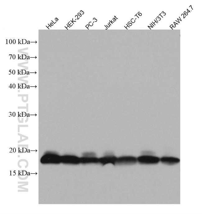 EIF5A Antibody in Western Blot (WB)