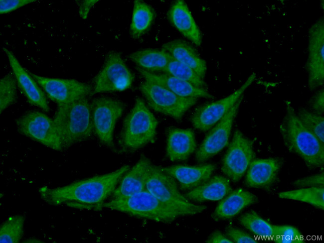 RPL17 Antibody in Immunocytochemistry (ICC/IF)