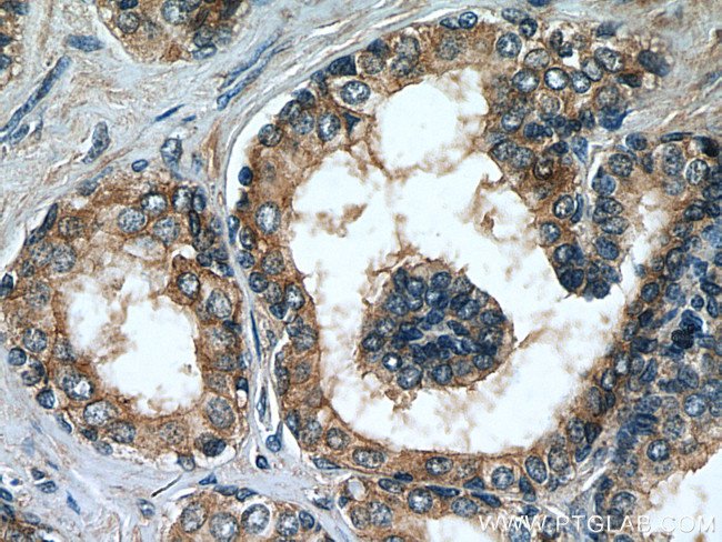 MRP4 Antibody in Immunohistochemistry (Paraffin) (IHC (P))