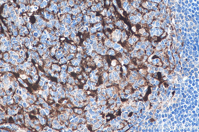 S100A1 Antibody in Immunohistochemistry (Paraffin) (IHC (P))