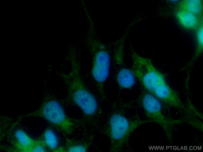 CDC27/APC3 Antibody in Immunocytochemistry (ICC/IF)