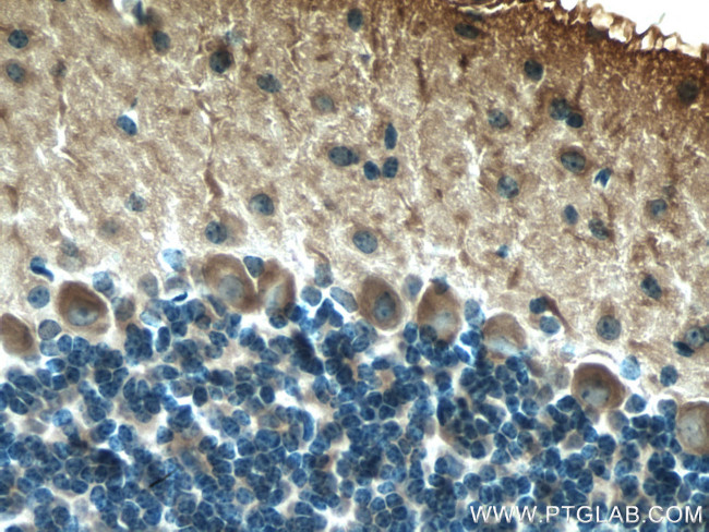 MYH10 Antibody in Immunohistochemistry (Paraffin) (IHC (P))