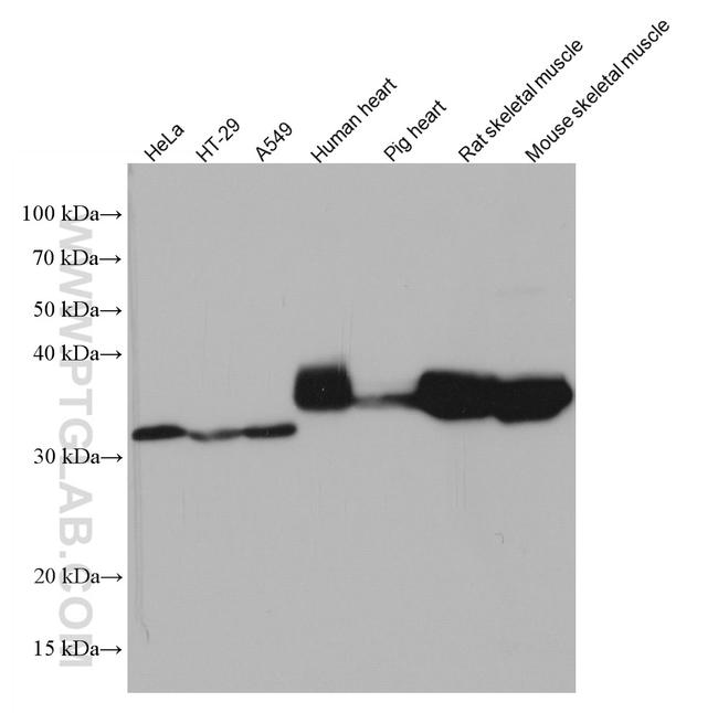 TPM4 Antibody in Western Blot (WB)