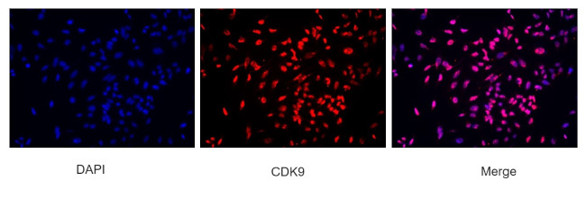 CDK9 Antibody in Immunocytochemistry (ICC/IF)