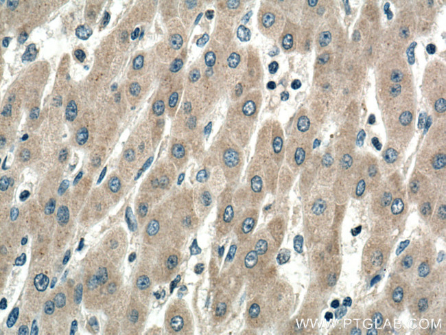 SIRT5 Antibody in Immunohistochemistry (Paraffin) (IHC (P))