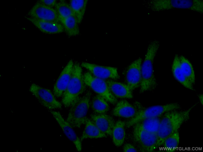 KRAS-2A Antibody in Immunocytochemistry (ICC/IF)